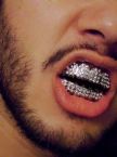Name:  teeth grill.jpg
Views: 459
Size:  3.9 KB